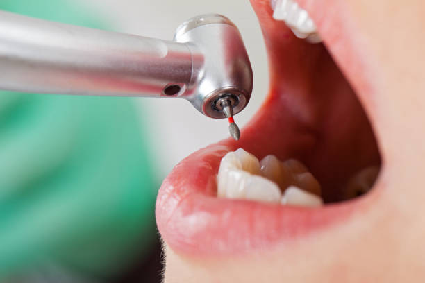 Best Weekend Emergency Dental Services in Shelbyville, KY